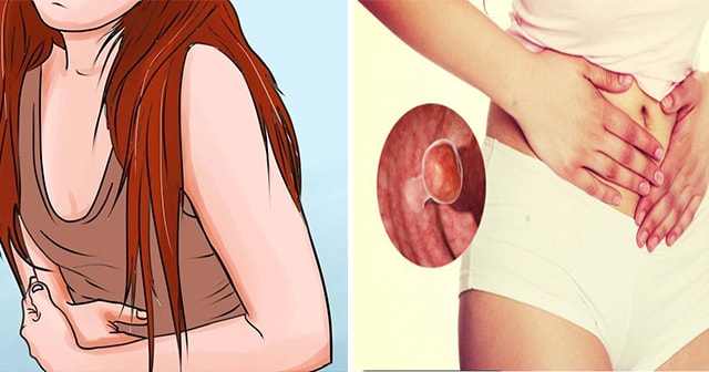 These are The 4 Uncommon Signs of Colon Cancer that Many People Accidentally Ignore
